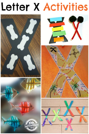 letter x activities for kids - Kids Activities Blog - shown are x-ray, x-ray fish and xylophone